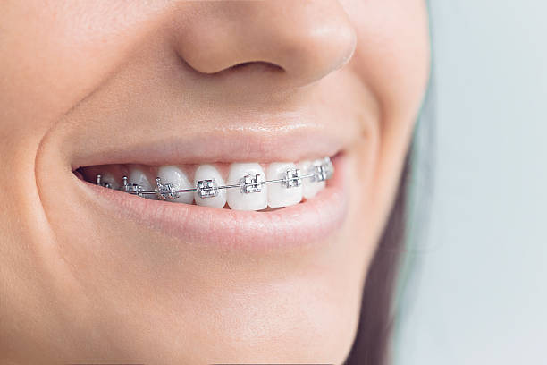 Best Dentures (Full and Partial)  in Bridgeport, OH